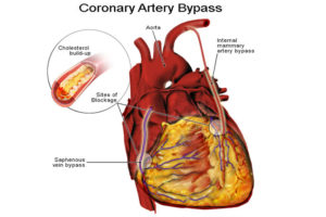 Awarded Heart surgeon in India