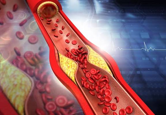 Arterial type coronary artery bypass surgery